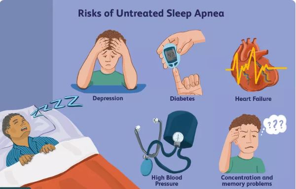 sleep apnea